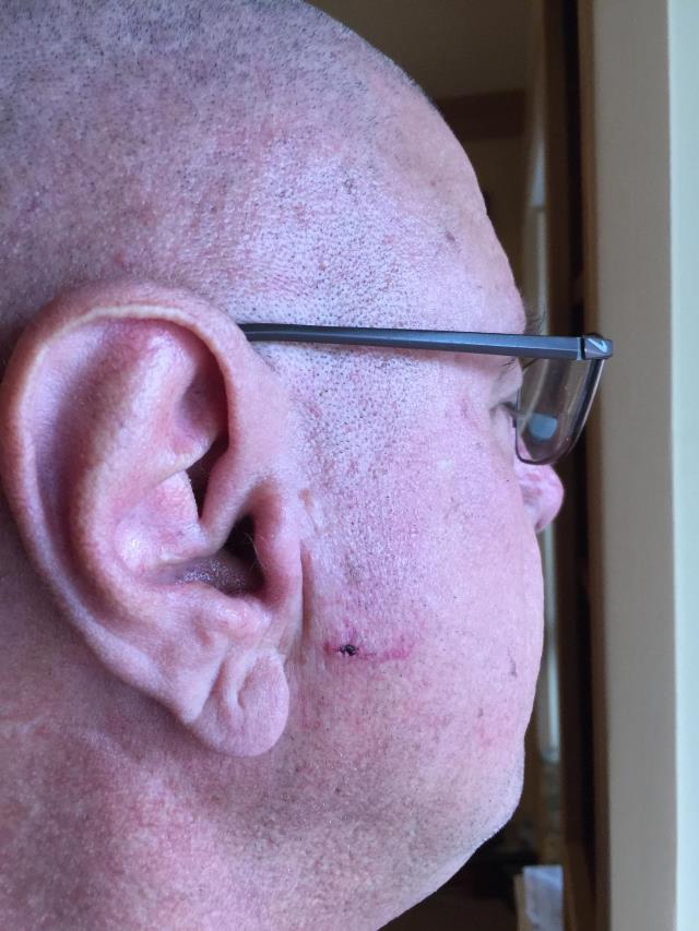 Buddhist Monk Kozen Sampson was injured in a Feb. 29, 2016 attack by a stranger in what Hood River police said may be a hate crime. Sampson suffered a facial gash. March 9, 2016 (KOIN)