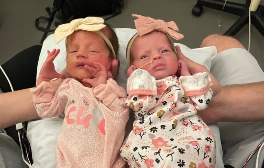 Twin girls survive pregnancy thanks to OHSU's fetal surgeons